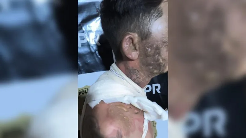 Mulher é presa após jogar panela de água fervendo em homem, em Palotina