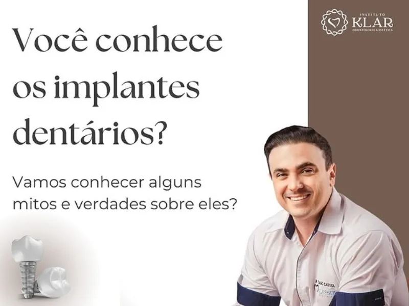 Conheça os mitos e verdades sobre os Implantes Dentários!