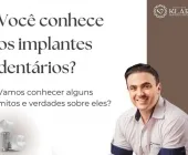 Conheça os mitos e verdades sobre os Implantes Dentários!