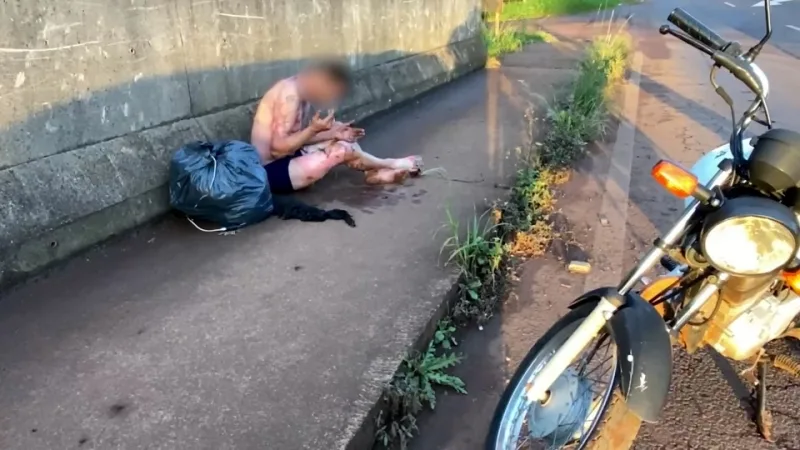 Homem tem corpo incendiado com álcool durante briga em Cascavel