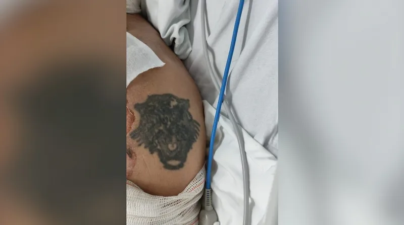 HU pede ajuda para identificar paciente com queimaduras graves; Ele seria morador de Marechal Rondon