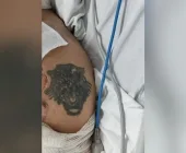 HU pede ajuda para identificar paciente com queimaduras graves; Ele seria morador de Marechal Rondon