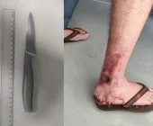 Homem é esfaqueado pela esposa durante briga em Toledo